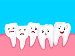 Misaligned Mouths - What Causes Dental Drifting