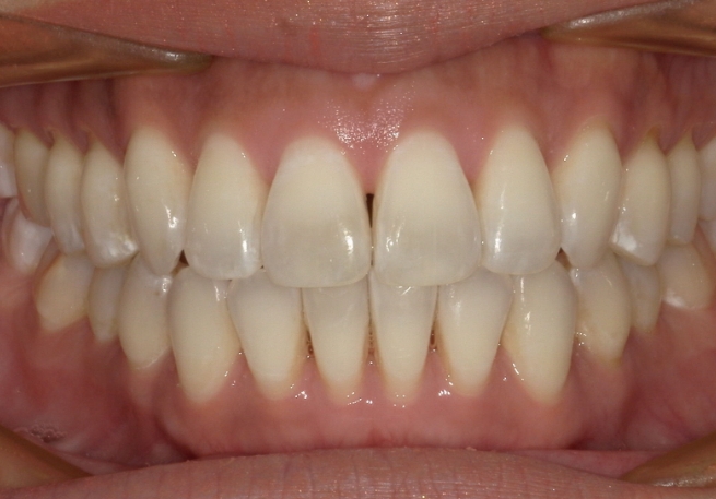 Dental Smile Gallery 1-2