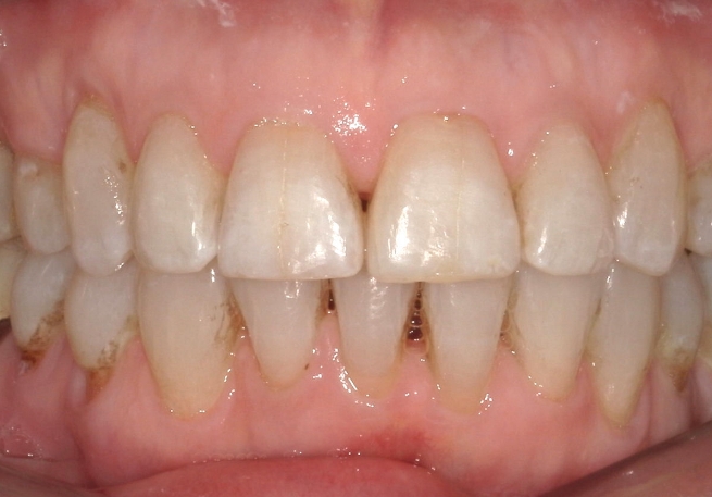 Dental Smile Gallery 4-2