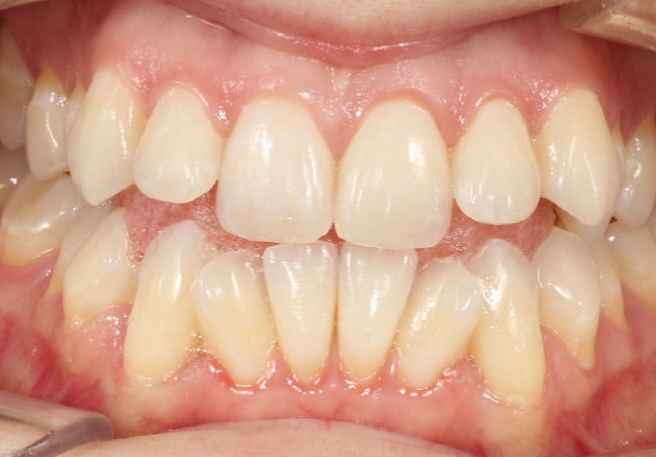 Dental Smile Gallery 6-1