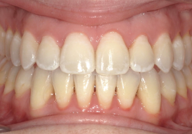 Dental Smile Gallery 6-2