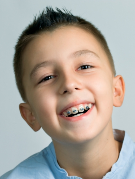 What Happens During Phase II Orthodontics